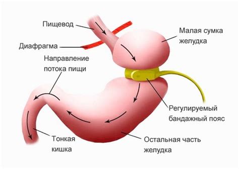 Операция на желудок для похудения виды и особенности